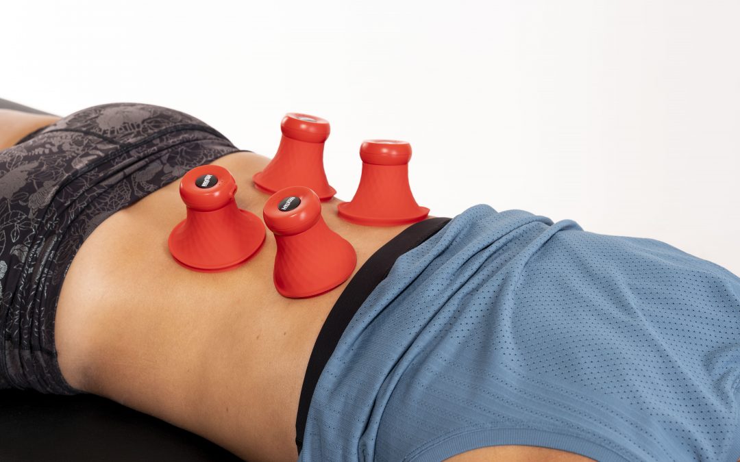 Uncover the NEW Science Behind Myofascial Cupping: A Neurosensory Solution for Low Back Pain. By Dr Steve Capobianco