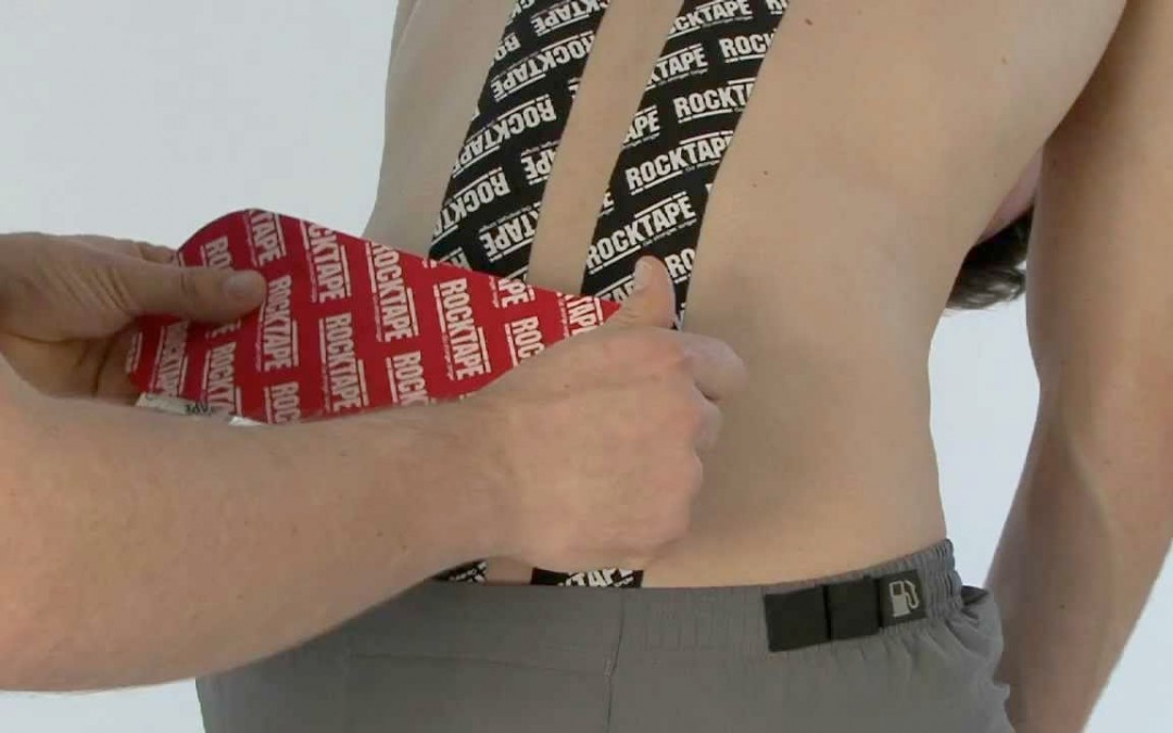 Kinesiology tape shown to help acute low back pain