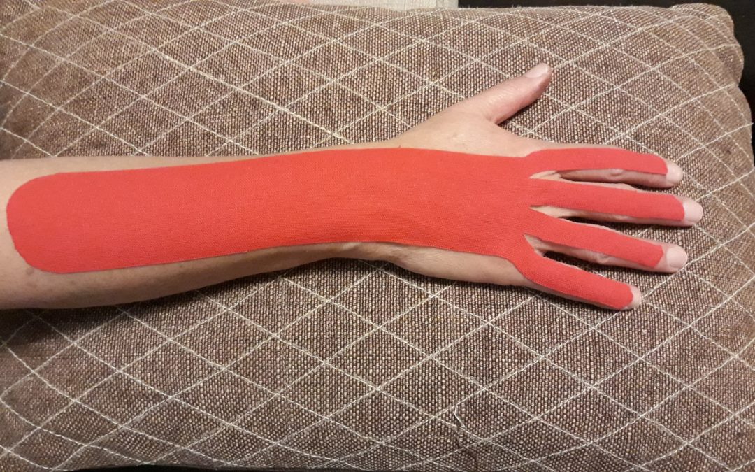 A study of participants with carpal tunnel syndrome and how they felt with kinesiology taping applied