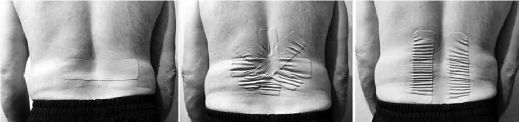 Different taping techniques for persistent low back pain-does it matter how you tape?